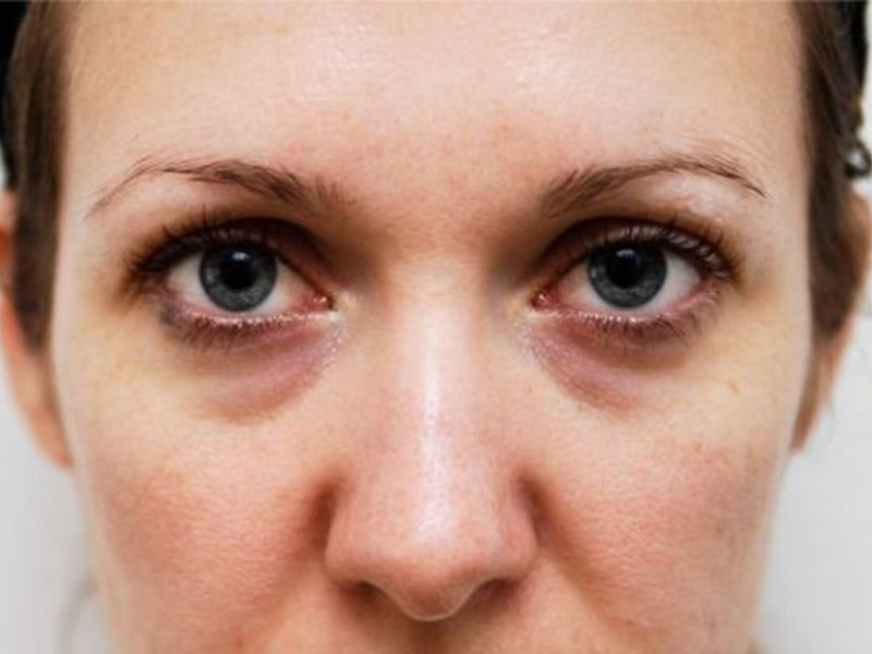 co-the-dang-cau-cuu-ban-qua-5-dau-hieu-nay