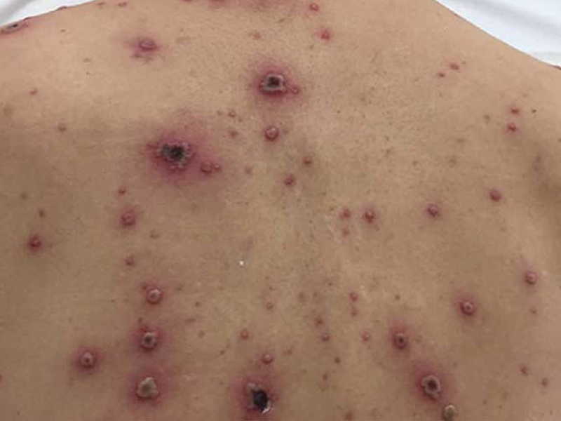 mac-thuy-dau-chang-trai-vam-vo-bi-suy-gan-kho-qua-khoi