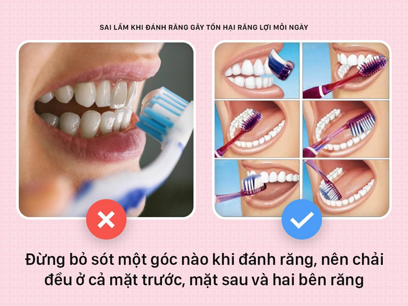 nhieu-nguoi-dang-danh-rang-sai-cach