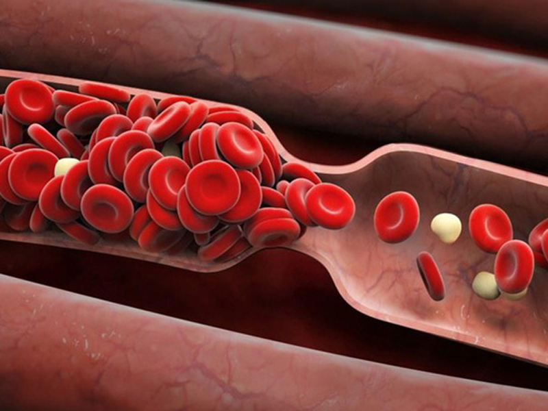 than-duoc-tu-nhien-giup-ngua-mau-dong-kiem-soat-huyet-ap