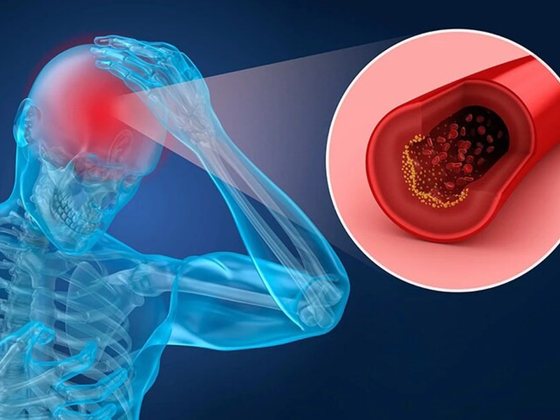 tranh-dot-quy-bang-cach-don-gian-ai-cung-lam-duoc